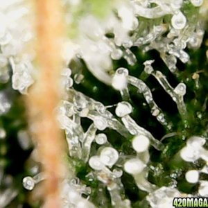 my first trichomes pics