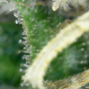 Trichs