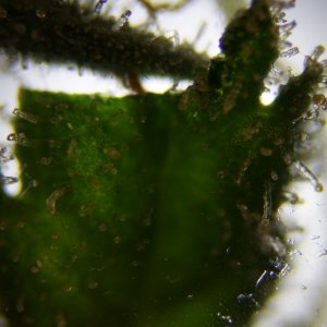 photomicrography - trichomes