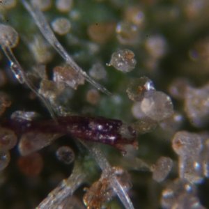 Trichomes under the microscope