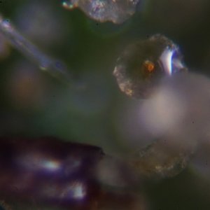 Trichomes under the microscope