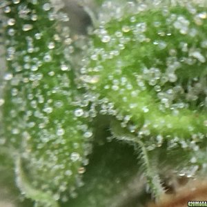 Thai Stick Trichs At 18 Weeks