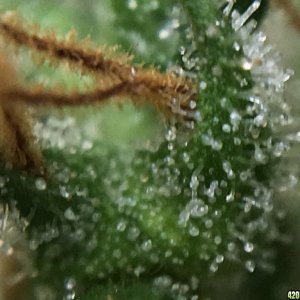 Thai Stick Trichs At 18 Weeks