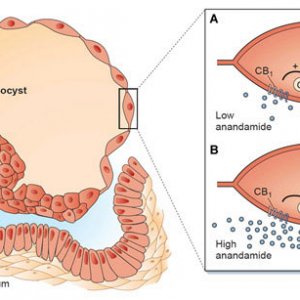 Uterine Diagram