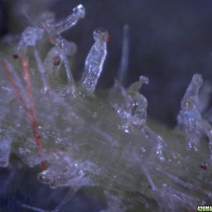 fun with trichs 11-16-10