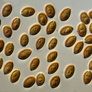 PsilocybeCubensisSpores@1000x.jpg