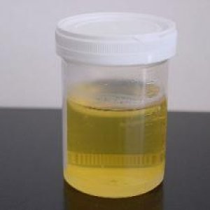 800px-Urine_sample_4