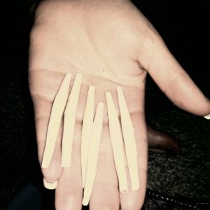 Joints In Woman's Hand