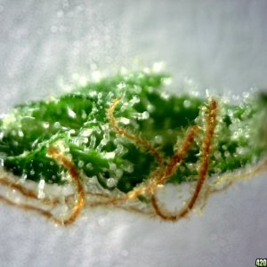 Underside of sugar leaf from right lady @~200x