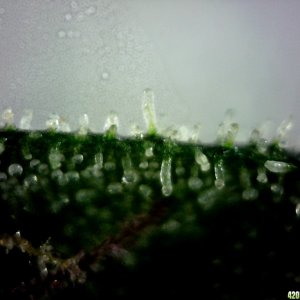 Underside of a sugar leaf from the B/R lady @ ~400X