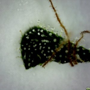 Topside of a sugar leaf from the B/R lady @ ~200X