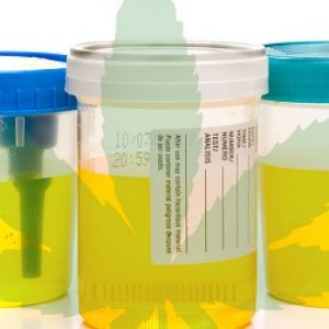 urine test