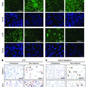 Cannabinoid action induces autophagy-mediated cell death through stimulatio