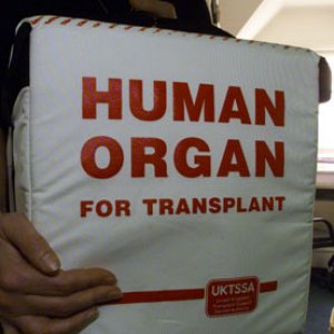 organ donating