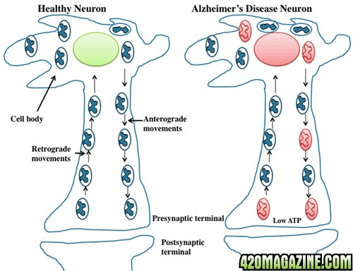 AD_Neuron