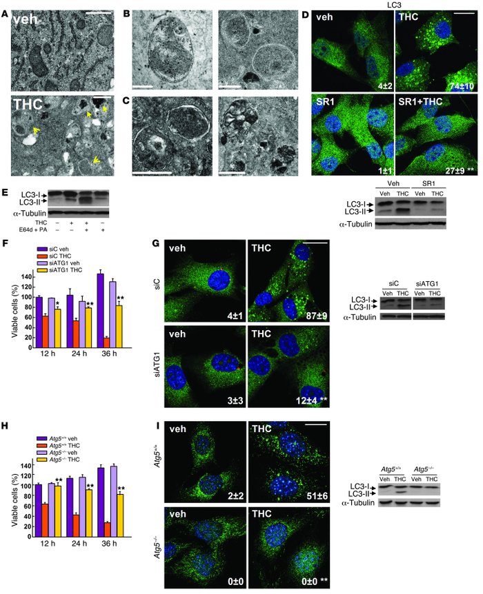 Cannabinoid action induces autophagy-mediated cell death through stimulatio