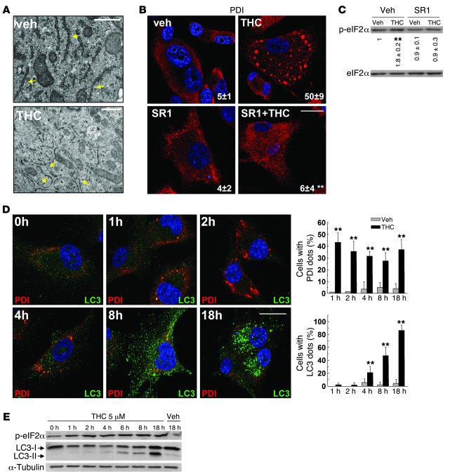 Cannabinoid action induces autophagy-mediated cell death through stimulatio