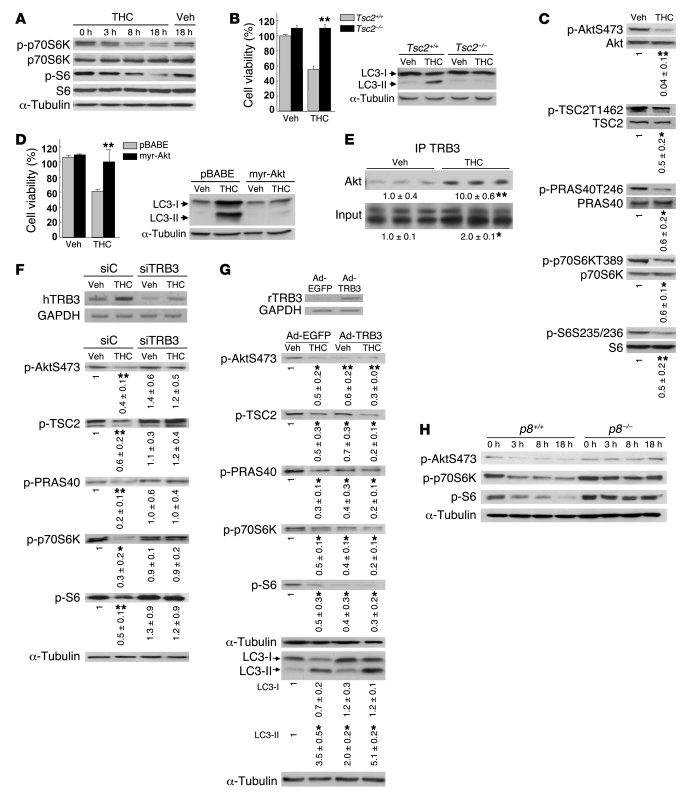 Cannabinoid action induces autophagy-mediated cell death through stimulatio