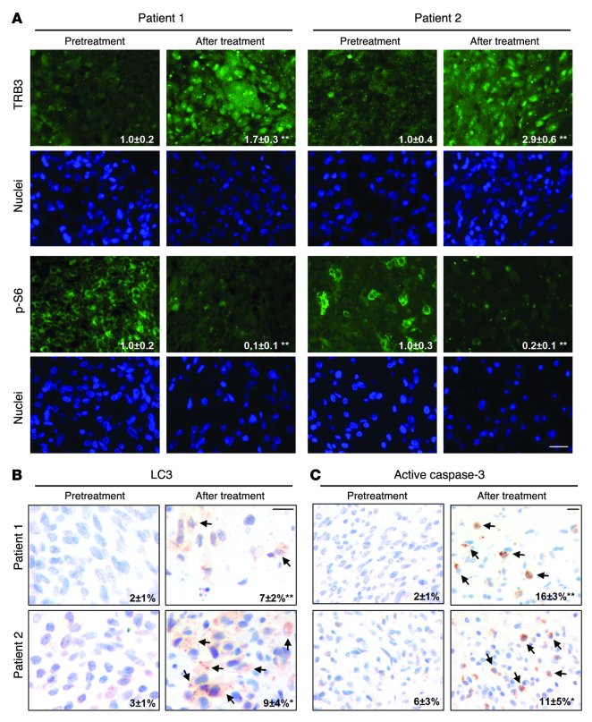 Cannabinoid action induces autophagy-mediated cell death through stimulatio