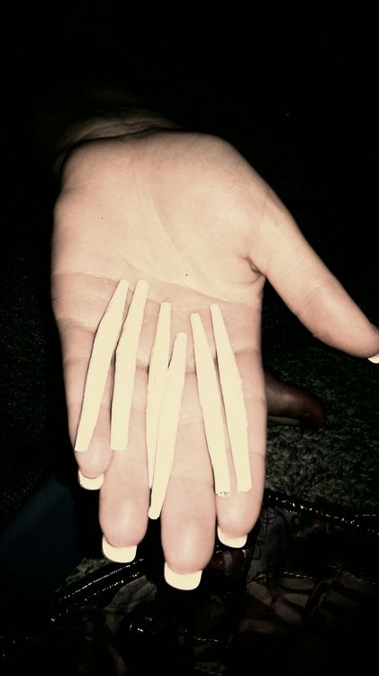 Joints In Woman's Hand