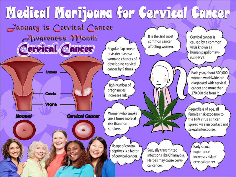 MMJ for Cervical Cancer