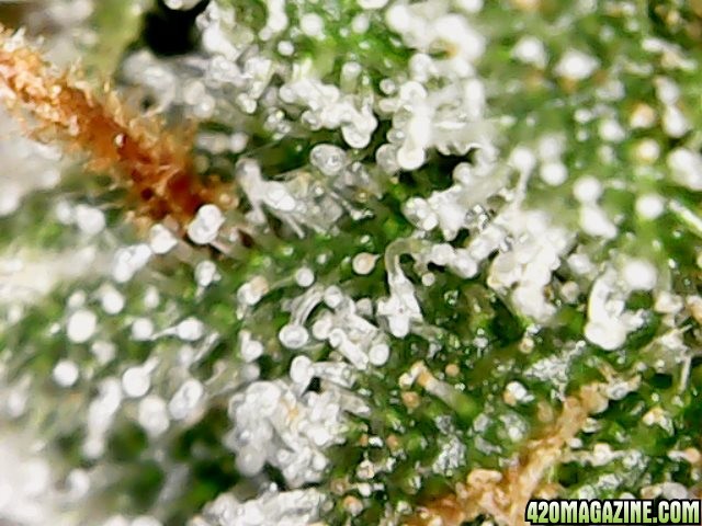 my first trichomes pics