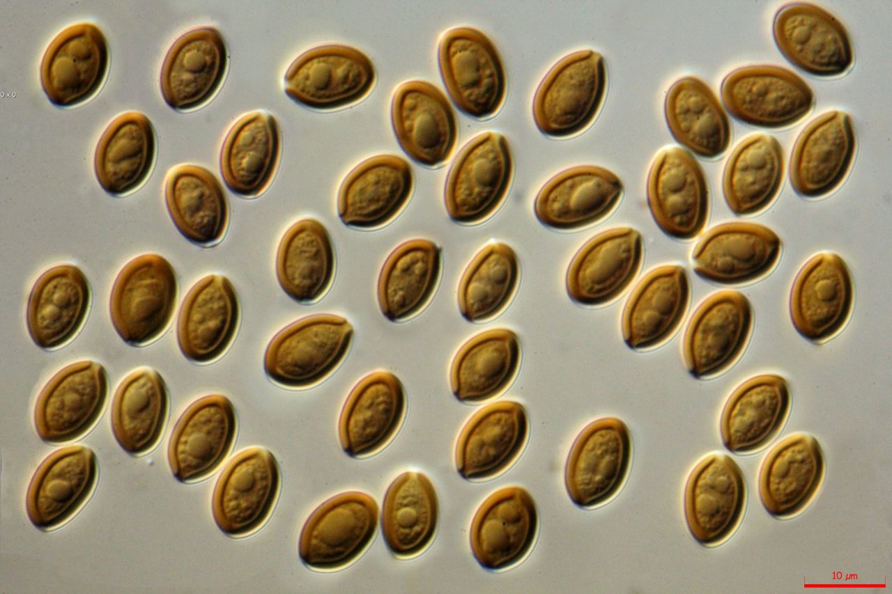 PsilocybeCubensisSpores@1000x.jpg