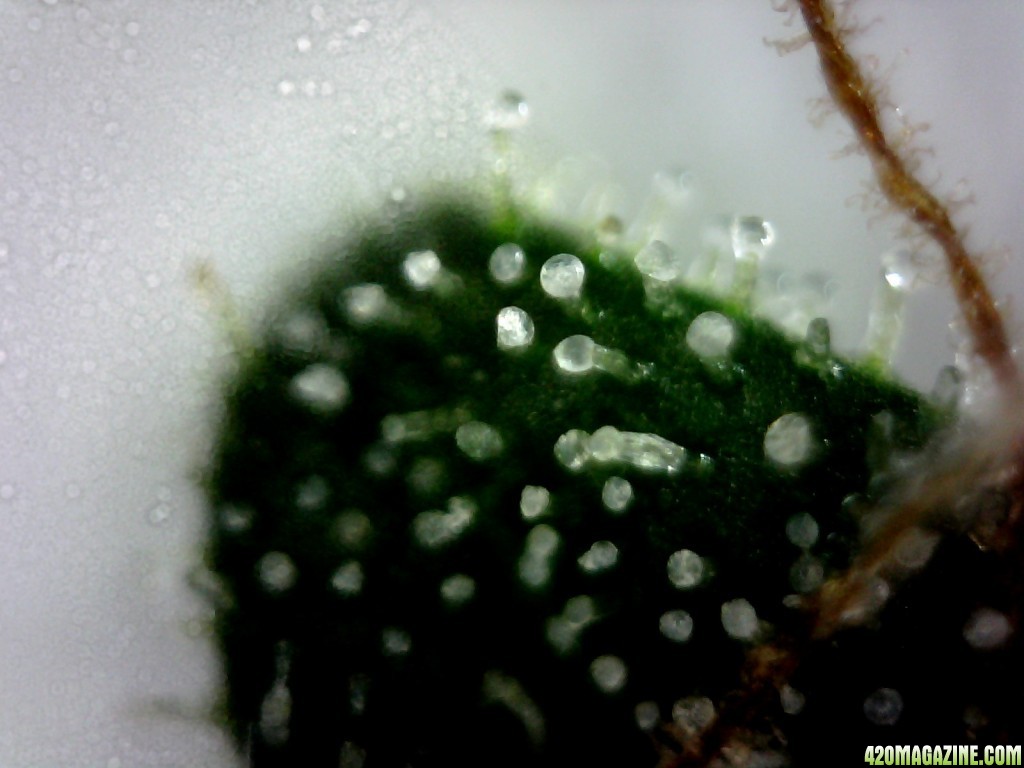 Topside of a sugar leaf from the B/R lady @ ~400X